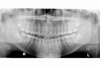 Centre Dentaire IED Implantologie Esthétique Dentisterie Générale Pierrefonds Montréal Quebec Dentistes