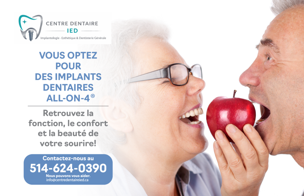 Procédure All-on-4 pour remplacement complet des dents