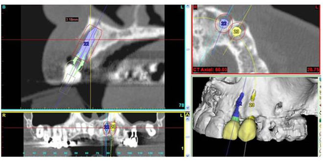 Centre Dentaire IED Implantologie Esthétique Dentisterie Générale Pierrefonds Montréal Quebec Dentistes
