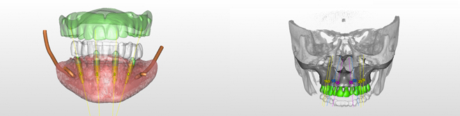 Centre Dentaire IED Implantologie Esthétique Dentisterie Générale Pierrefonds Montréal Quebec Dentistes